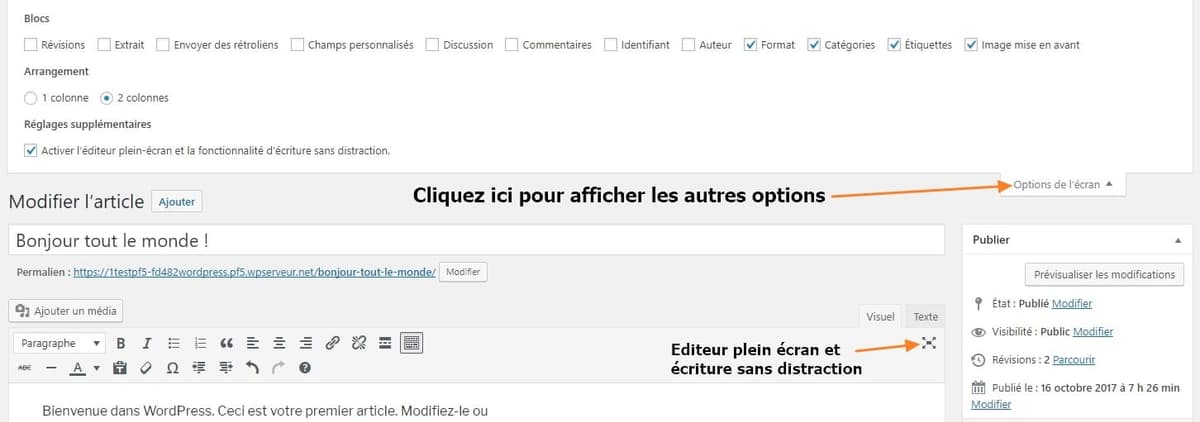autres options disponibles dans les articles