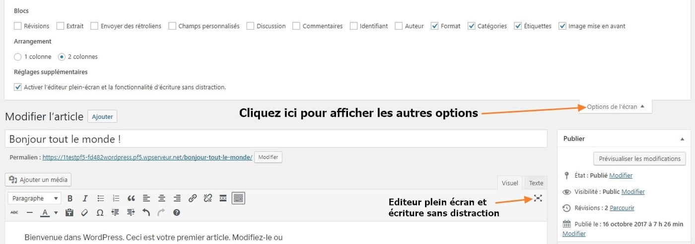 autres options disponibles dans les articles