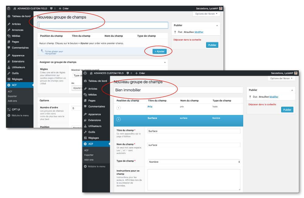 Créer un groupe de champs avec ACF
