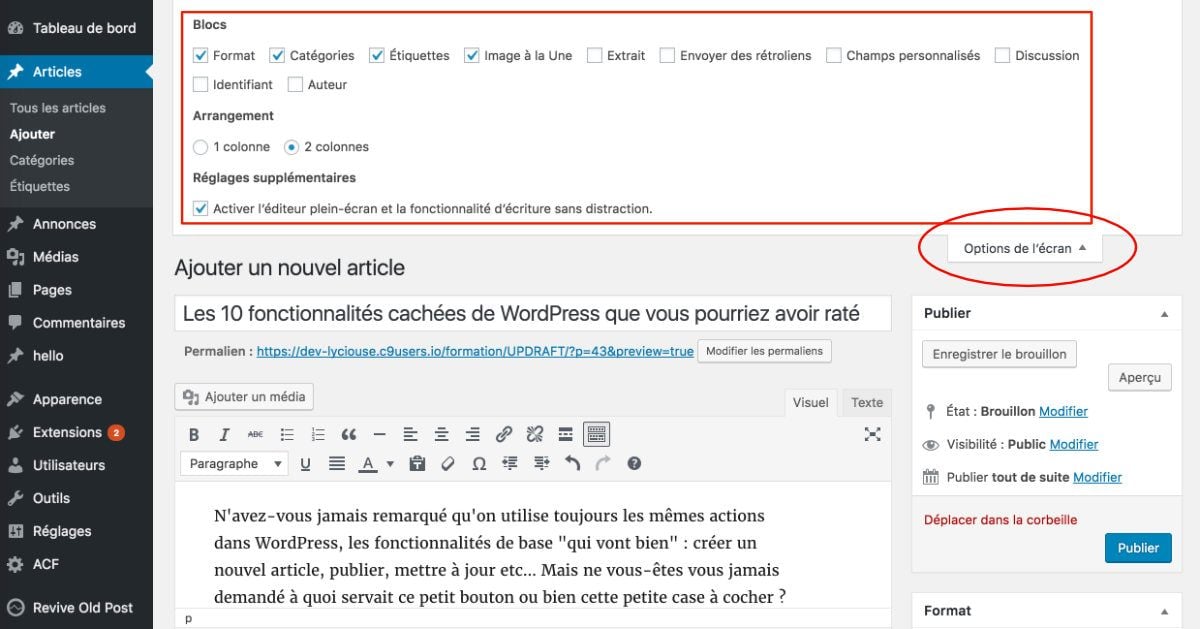 Options de l'écran dans un articlearticle